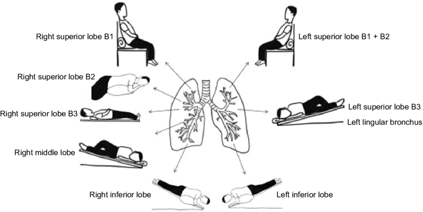 Treating pneumonia in an emergency